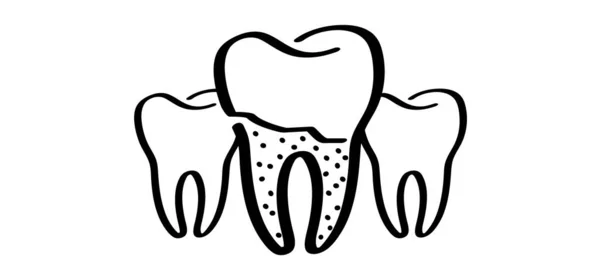 漫画の健康 歯茎と歯 ラインパターン ベクトル図面シルエットアイコン 歯や歯に損傷を与えます 歯が割れ 損傷しました 強いエナメル質疾患 — ストックベクタ
