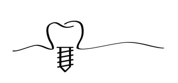 Tandimplantat Medicinskt Korrekt Eller Tandbro Tecknad Frisk Tand Med Tandkött — Stock vektor