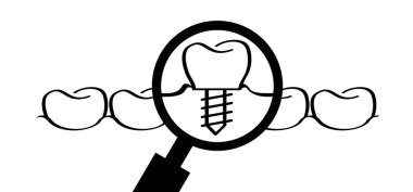 Diş implantı, tıbbi olarak doğru ya da diş köprüsü. Sağlıklı çizgi film, diş eti ve diş eti. Azı dişi izi. Vidayla diş çekmek. Dişleri ya da dişleri zarar görmüş. Cerrahi çene, ilaç vidası.