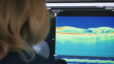 Göz muayenesi sonuçlarını inceleyen oftalmolog doktor monitöre bakıyor. Bilgisayar monitöründeki retina taramasına bakan oftalmolog. Oftalmoloji tedavisi