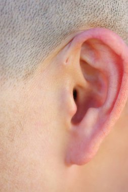Preauricular sinüs dış kulağın hemen önünde küçük bir çukur gibi görünür, bu sinüsler kötü kokan bir akıntıyı boşaltabilir, ve bu gerçekleştiğinde, kronik enfeksiyona eğilimlidirler..