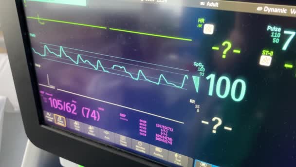 Kórházi Szívfrekvencia Életjelek Monitorozása — Stock videók