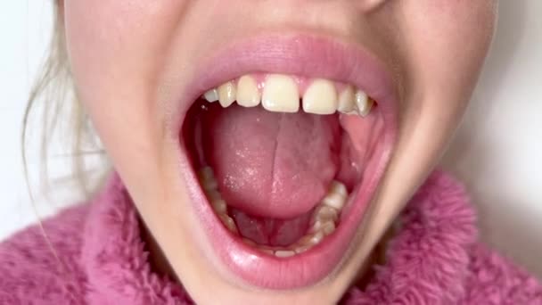 Menina Adolescente Onze Anos Abre Boca Mostra Dentes Gengivas Garganta — Vídeo de Stock