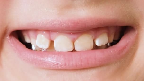 Κορίτσι Κορίτσι Επτά Ετών Που Δείχνει Δόντια Της Στον Οδοντίατρο — Αρχείο Βίντεο