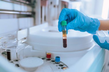 Kadın laboratuvar teknisyeni kan örnekleriyle test tüplerini biyokimya santrifüj analizine koydu. Bilim ve tıp konsepti.