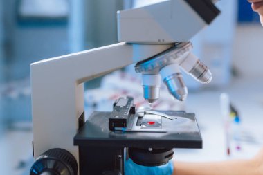 Dişi laboratuvar teknisyeni kan örneğini mikroskop incelemesi için hazırlıyor. Kan testi kavramı.