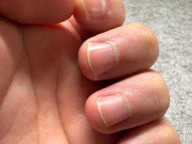 Gri arka planda kısa kesilmiş kirli erkek tırnakları. Yüksek kalite fotoğraf