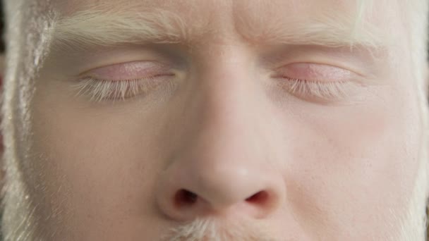 马可闭上白化病男子的蓝眼睛 冷静的男人看着相机 头发变色 皮肤苍白 多样性 平等和不同族裔的人的概念 — 图库视频影像