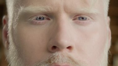 Renkli saçlı, soluk tenli bir erkek model. Çeşitlilik kavramı, eşitlik ve farklı ırktan ve milletten insanlar. Yakışıklı albino erkek gözlerini kapat. Gülümseyen rahat adam kameraya bakıyor.