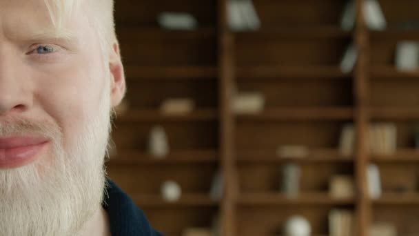 Positief Mens Kijkt Naar Camera Vrolijke Albino Lachende Kopieer Achtergrond — Stockvideo