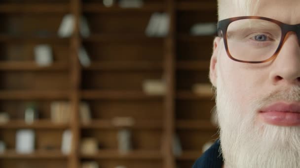 Şık Gözlüklü Albino Adamın Yüzünün Yarısı Yüzü Gülen Sarışın Bir — Stok video