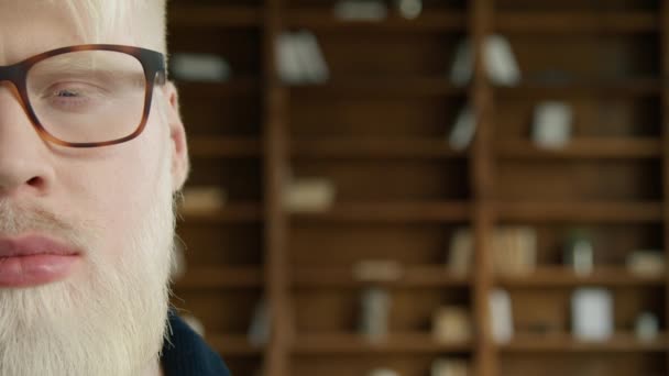 Arka Planda Kitap Raflarıyla Kameraya Poz Veren Yarım Suratlı Albino — Stok video