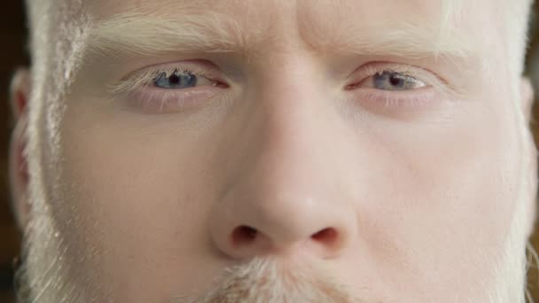 Усміхнений Розслаблений Чоловік Дивиться Камеру Чоловіча Модель Розфарбованим Волоссям Блідою — стокове відео