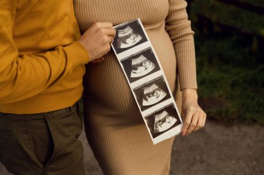 a pregnant couple holds an ultrasound picture on the background of the abdomen. close-up of a pregnant belly. 4d ultrasound of the fetus.modern ultrasound picture.