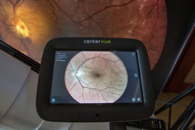 Kyiv, Ukrayna - 18 Nisan 2024: Ultra yüksek çözünürlüklü geniş çözünürlüklü fundus görüntüleme için geniş açı retina kamerası. Retina hastalıklarının teşhisi için tasarlanmıştır..