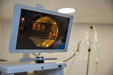 Kyiv, Ukrayna - Nisan 05, 2025: Sony monitörü ameliyathanede artroskopi yapmak için kullanıldı. Bilgisayar yardım aygıtı.