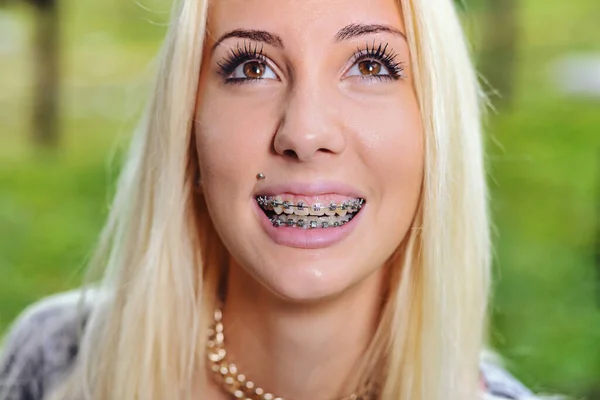 Questo Ritratto Una Ragazza Sorridente Due File Denti Con Apparecchio — Foto Stock