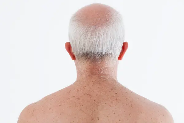 Back View Senior Man Showcasing Natural Aging Time Effects — Stock Photo, Image