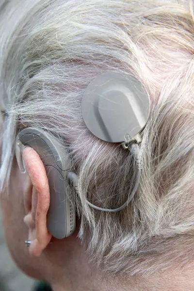 The back of an elderly person\'s head, clearly showing a hearing aid called a cochlear implant. You can clearly see the implant on the side of the back of the head on gray hair