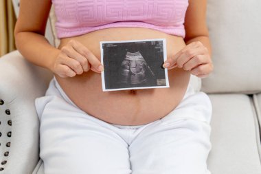 Hamile bir kadının iki eliyle ultrason görüntüsüyle oturma odasındaki kanepeye oturup gülümsemesi..