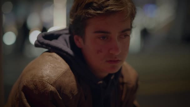 Nejistý Mladý Muž Osoba Akné Pupínky Obličeji Sledování Lidí Dojíždějících — Stock video