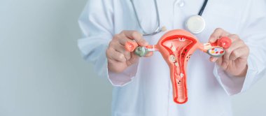 Doctor holding Uterus and Ovaries model. Ovarian and Cervical cancer, Cervix disorder, Endometriosis, Hysterectomy, Uterine fibroids, Reproductive system and Pregnancy concept