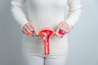 Woman holding Uterus and Ovaries model. Ovarian and Cervical cancer, Cervix disorder, Endometriosis, Hysterectomy, Uterine fibroids, Reproductive system and Pregnancy concept