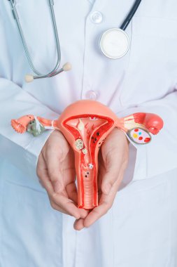 Doctor holding Uterus and Ovaries model. Ovarian and Cervical cancer, Cervix disorder, Endometriosis, Hysterectomy, Uterine fibroids, Reproductive system and Pregnancy concept