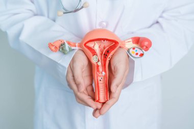 Doctor holding Uterus and Ovaries model. Ovarian and Cervical cancer, Cervix disorder, Endometriosis, Hysterectomy, Uterine fibroids, Reproductive system and Pregnancy concept