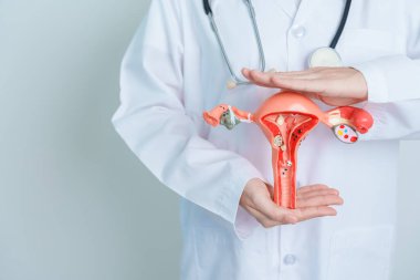 Doctor holding Uterus and Ovaries model. Ovarian and Cervical cancer, Cervix disorder, Endometriosis, Hysterectomy, Uterine fibroids, Reproductive system and Pregnancy concept