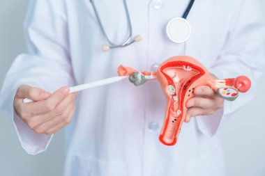 Doctor holding Uterus and Ovaries model. Ovarian and Cervical cancer, Cervix disorder, Endometriosis, Hysterectomy, Uterine fibroids, Reproductive system and Pregnancy concept