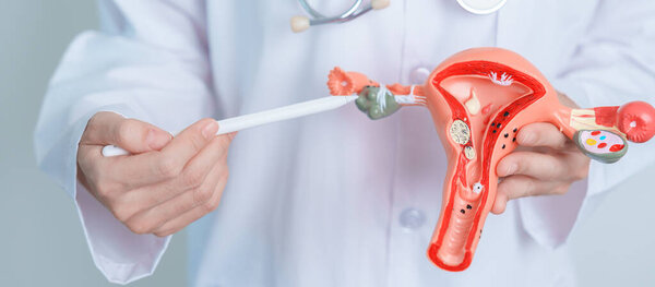 Doctor holding Uterus and Ovaries model. Ovarian and Cervical cancer, Cervix disorder, Endometriosis, Hysterectomy, Uterine fibroids, Reproductive system and Pregnancy concept
