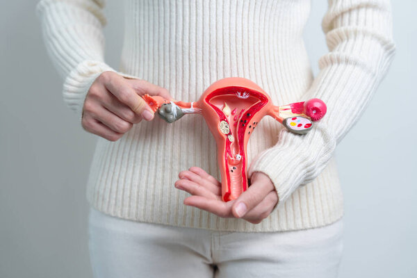 Woman holding Uterus and Ovaries model. Ovarian and Cervical cancer, Cervix disorder, Endometriosis, Hysterectomy, Uterine fibroids, Reproductive system and Pregnancy concept