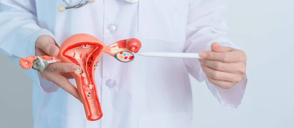 Doctor Holding Uterus Ovaries Model Ovarian Cervical Cancer Cervix Disorder — Stock Fotó