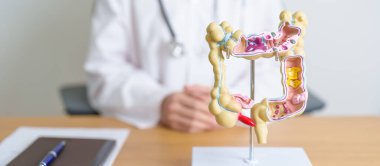 İnsan kolon anatomisi modeli olan bir doktor. Kolon hastalığı, kalın bağırsak kanseri, renk kanseri, ülseratif kolit, divertikülit, hassas bağırsak sendromu, sindirim sistemi ve sağlık konsepti.