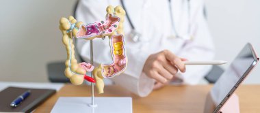 Kolon anatomisi modeli ve tableti olan bir doktor. Kolon hastalığı, kalın bağırsak kanseri, renk kanseri, ülseratif kolit, divertikülit, hassas bağırsak sendromu ve sindirim sistemi. 