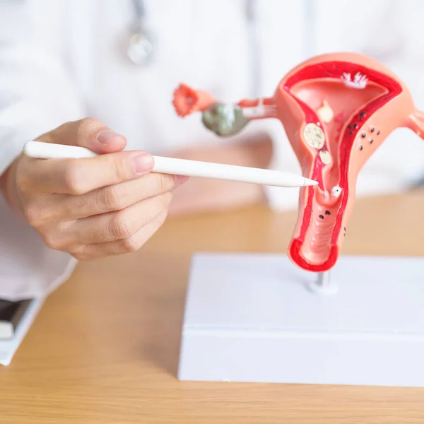 stock image Doctor with Uterus and Ovaries anatomy model. Ovarian and Cervical cancer, Cervix disorder, Endometriosis, Hysterectomy, Uterine fibroids, Reproductive system, Pregnancy and health concept