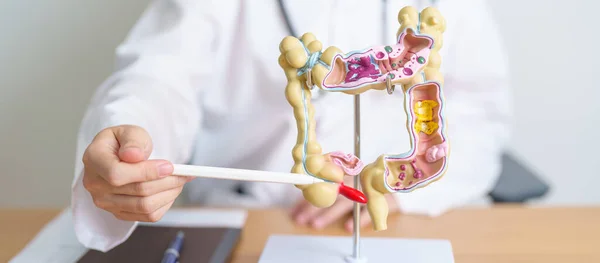 İnsan kolon anatomisi modeli olan bir doktor. Kolon hastalığı, kalın bağırsak kanseri, renk kanseri, ülseratif kolit, divertikülit, hassas bağırsak sendromu, sindirim sistemi ve sağlık konsepti.