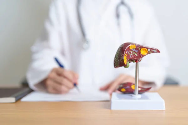 Arzt Mit Menschlichem Leberanatomie Modell Leberkrebs Und Tumor Gelbsucht Virale — Stockfoto