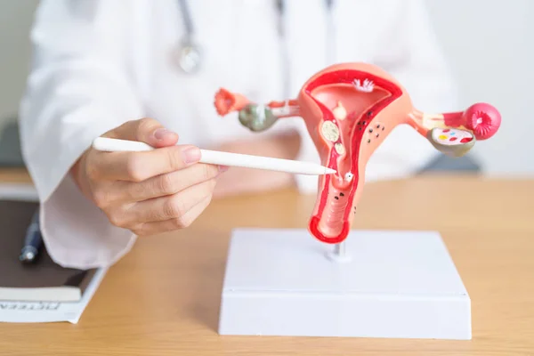 stock image Doctor with Uterus and Ovaries anatomy model. Ovarian and Cervical cancer, Cervix disorder, Endometriosis, Hysterectomy, Uterine fibroids, Reproductive system, Pregnancy and health concept