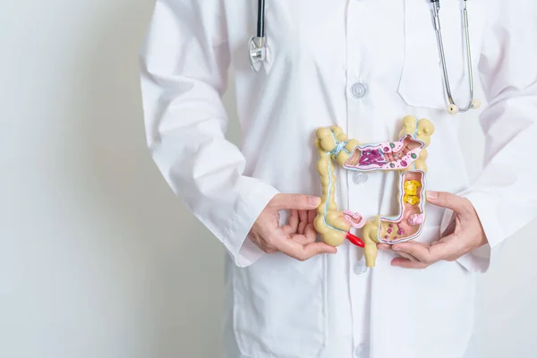 Arzt Mit Menschlichem Anatomiemodell Des Dickdarms Darmkrankheit Dickdarmkrebs Darmkrebs Colitis — Stockfoto