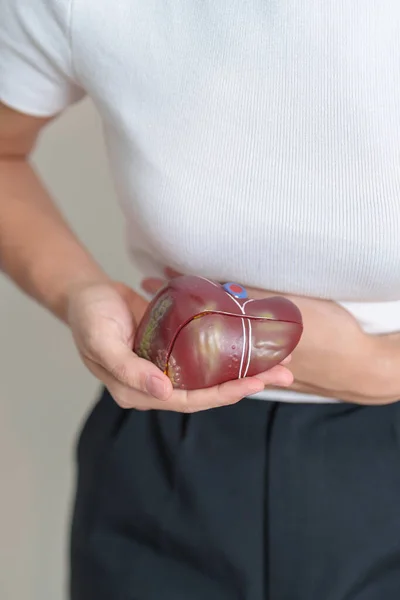 Woman holding human Liver anatomy model. Liver cancer and Tumor, Jaundice, Viral Hepatitis A, B, C, D, E, Cirrhosis, Failure, Enlarged, Hepatic Encephalopathy, Ascites Fluid in Belly and health