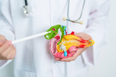 Pankreas, safra kesesi, Bile Duct, Duodenum, ince bağırsak ile insan pankreatiti anatomisi modeli olan bir doktor. Pankreas kanseri, Akut ve Kronik pankreas iltihabı, Sindirim Sistemi ve Sağlık Konsepti