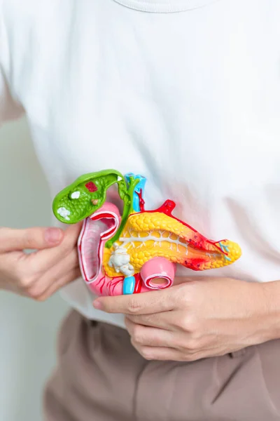 Woman holding human Pancreatitis anatomy model with Pancreas, Gallbladder, Bile Duct, Duodenum, Small intestine. Pancreatic cancer, Acute and Chronic pancreatitis,  Digestive system and Health concept