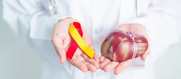 Doctor with Red and Yellow ribbon and human Liver anatomy model. World hepatitis day, 28 July, Liver cancer awareness month, Jaundice, Cirrhosis, Failure, Enlarged, Hepatic Encephalopathy and Health