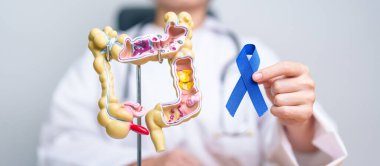 Doktor elinde mavi kurdele ve insan kolon anatomisi modeli tutuyor. Mart Renkli Kanser Farkındalık Ayı, Kolon Hastalığı, Kalın bağırsak, Ülseratif Kolit, Sindirim Sistemi ve Sağlık Konsepti