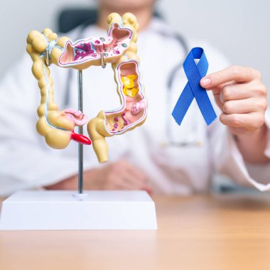 Doktor elinde mavi kurdele ve insan kolon anatomisi modeli tutuyor. Mart Renkli Kanser Farkındalık Ayı, Kolon Hastalığı, Kalın bağırsak, Ülseratif Kolit, Sindirim Sistemi ve Sağlık Konsepti
