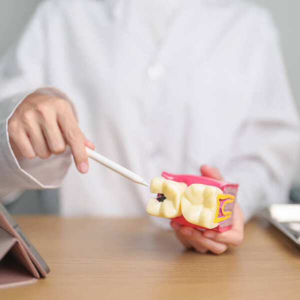 Dentist with tooth Anatomy model. Oral Teeth decay and disease, Scrape off tartar. March Oral health, Dentist Day, False Teeth. Toothache and Children Dental Health Month and Orthodontic Health Day