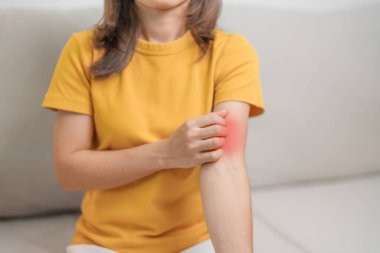 woman itching and scratching itchy arm. Sensitive Skin Allergic reaction to insect bite, food, drug dermatitis. Dermatology, Leprosy day, Systemic lupus erythematosus, Allergy symptoms and rash Eczema clipart