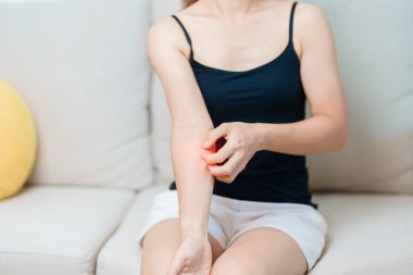 Kaşınan ve kaşınan bir kadın. Böcek ısırığına karşı hassas deri alerjisi, yemek, uyuşturucu dermatiti. Dermatoloji, cüzzam günü, sistemik lupus eritematoz, alerji semptomları ve isilik.